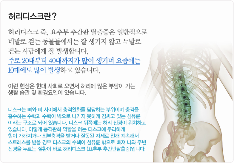 허리디스크란? 허리디스크 즉, 요추부 추간판 탈출증은 일반적으로 네발로 걷는 동물들에서는 잘 생기지 않고 두발로 걷는 사람에게 잘 발생합니다. 주로 20대부터 40대까지가 많이 생기며 요즘에는 10대에도 많이 발생하고 있습니다. 이런 현상은 현대 사회로 오면서 허리에 많은 부담이 가는 생활 습관 및 환경요인이 있습니다. 디스크는 뼈와 뼈 사이에서 충격완화를 담당하는 부위이며 충격을 흡수하는 수핵과 수핵이 밖으로 나가지 못하게 감싸고 있는 섬유륜 이라는 구조로 되어 있습니다. 디스크 뒤쪽에는 허리 신경이 위치하고 있습다. 이렇게 충격완화 역할을 하는 디스크에 무리하게 힘이 가해지거나 외부충격을 받거나 잘못된 자세로 인해 계속해서 스트레스를 받을 경우 디스크의 수핵이 섬유륜 밖으로 빠져 나와 주변 신경을 누르는 질환이 바로 허리디스크 (요추부 추간판탈출증)입니다. 